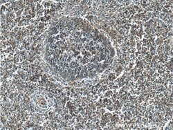 CD41/Integrin alpha 2b Rabbit anti-Human, Mouse, Rat, Polyclonal, Proteintech:Antibodies:Primary