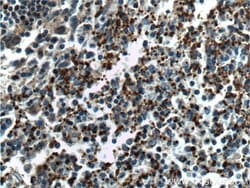 CD41/Integrin alpha 2b Rabbit anti-Human, Mouse, Rat, Polyclonal, Proteintech:Antibodies:Primary