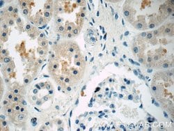 FBXW5 Rabbit anti-Human, Mouse, Rat, Polyclonal, Proteintech:Antibodies:Primary