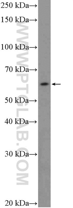 FBXW5 Rabbit anti-Human, Mouse, Rat, Polyclonal, Proteintech:Antibodies:Primary