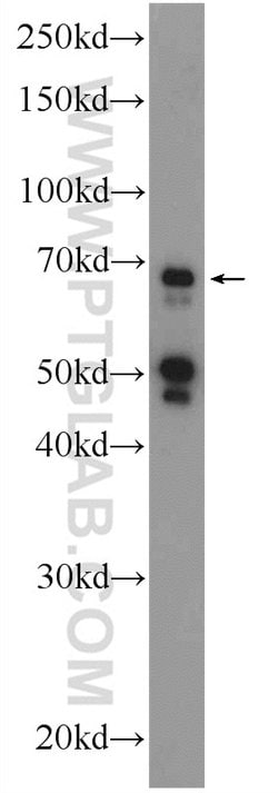 FBXW5 Rabbit anti-Human, Mouse, Rat, Polyclonal, Proteintech:Antibodies:Primary