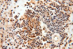 MAD1 Rabbit anti-Human, Mouse, Rat, Polyclonal, Proteintech:Antibodies:Primary