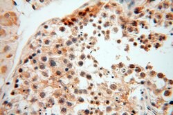 MAD1 Rabbit anti-Human, Mouse, Rat, Polyclonal, Proteintech:Antibodies:Primary