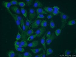 SSH3 Rabbit anti-Human, Mouse, Rat, Polyclonal, Proteintech:Antibodies:Primary