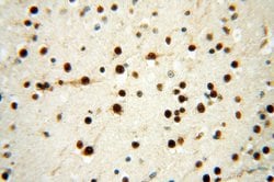 SSH3 Rabbit anti-Human, Mouse, Rat, Polyclonal, Proteintech:Antibodies:Primary