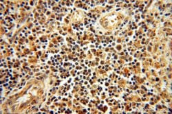 SSH3 Rabbit anti-Human, Mouse, Rat, Polyclonal, Proteintech:Antibodies:Primary