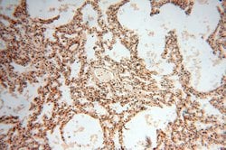 SSH3 Rabbit anti-Human, Mouse, Rat, Polyclonal, Proteintech:Antibodies:Primary