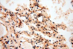 SSH3 Rabbit anti-Human, Mouse, Rat, Polyclonal, Proteintech:Antibodies:Primary
