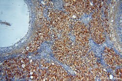 SSH3 Rabbit anti-Human, Mouse, Rat, Polyclonal, Proteintech:Antibodies:Primary