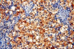 SSH3 Rabbit anti-Human, Mouse, Rat, Polyclonal, Proteintech:Antibodies:Primary