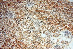SSH3 Rabbit anti-Human, Mouse, Rat, Polyclonal, Proteintech:Antibodies:Primary