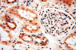 SSH3 Rabbit anti-Human, Mouse, Rat, Polyclonal, Proteintech:Antibodies:Primary