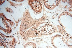 SSH3 Rabbit anti-Human, Mouse, Rat, Polyclonal, Proteintech:Antibodies:Primary
