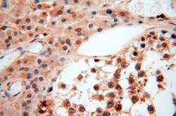 SSH3 Rabbit anti-Human, Mouse, Rat, Polyclonal, Proteintech:Antibodies:Primary
