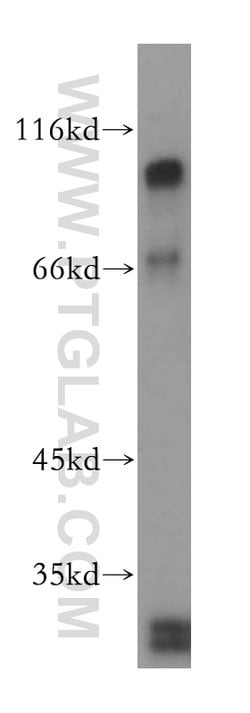 SSH3 Rabbit anti-Human, Mouse, Rat, Polyclonal, Proteintech:Antibodies:Primary