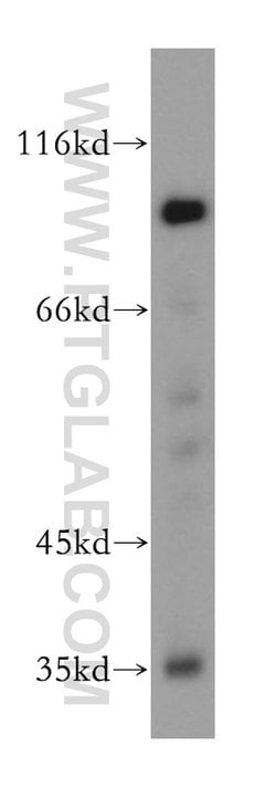 SSH3 Rabbit anti-Human, Mouse, Rat, Polyclonal, Proteintech:Antibodies:Primary