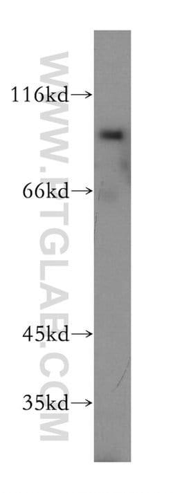SSH3 Rabbit anti-Human, Mouse, Rat, Polyclonal, Proteintech:Antibodies:Primary
