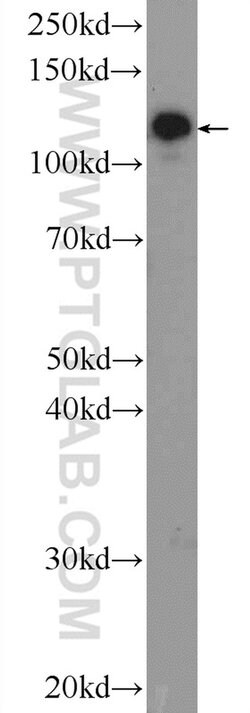 AP3B2 Rabbit anti-Human, Mouse, Rat, Polyclonal, Proteintech 150 &mu;L;
