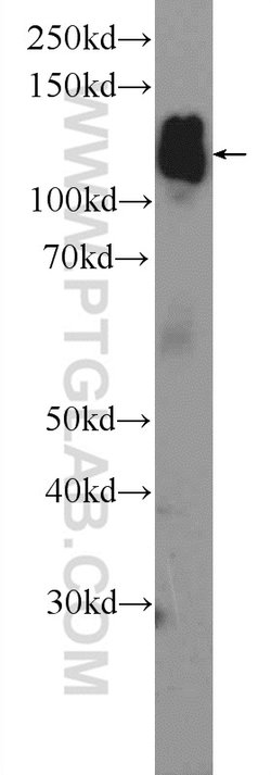 AP3B2 Rabbit anti-Human, Mouse, Rat, Polyclonal, Proteintech 150 &mu;L;
