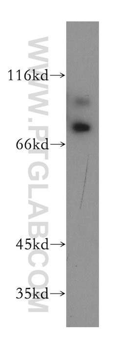 RAD18 Rabbit anti-Human, Mouse, Rat, Polyclonal, Proteintech:Anticuerpos:Anticuerpos