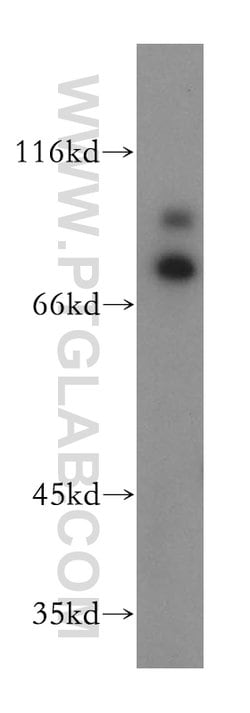 RAD18 Rabbit anti-Human, Mouse, Rat, Polyclonal, Proteintech:Anticuerpos:Anticuerpos