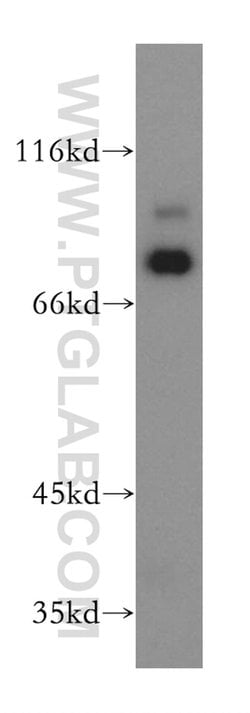 RAD18 Rabbit anti-Human, Mouse, Rat, Polyclonal, Proteintech