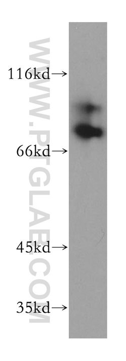 RAD18 Rabbit anti-Human, Mouse, Rat, Polyclonal, Proteintech:Anticuerpos:Anticuerpos