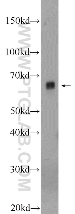 PIGS Rabbit anti-Human, Mouse, Polyclonal, Proteintech:  