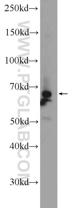 PIGS Rabbit anti-Human, Mouse, Polyclonal, Proteintech:  