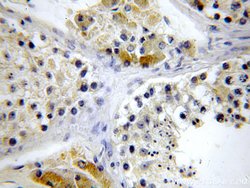 LSM14A Rabbit anti-Human, Mouse, Rat, Polyclonal, Proteintech:Antibodies:Primary
