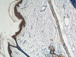 Plakophilin 3 Rabbit anti-Human, Mouse, Rat, Polyclonal, Proteintech:Antibodies:Primary