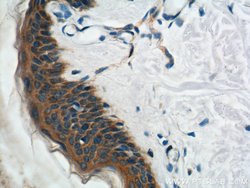 Plakophilin 3 Rabbit anti-Human, Mouse, Rat, Polyclonal, Proteintech:Antibodies:Primary