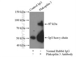 Plakophilin 3 Rabbit anti-Human, Mouse, Rat, Polyclonal, Proteintech:Antibodies:Primary