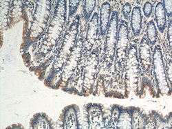 Plakophilin 3 Rabbit anti-Human, Mouse, Rat, Polyclonal, Proteintech:Antibodies:Primary