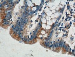 Plakophilin 3 Rabbit anti-Human, Mouse, Rat, Polyclonal, Proteintech:Antibodies:Primary