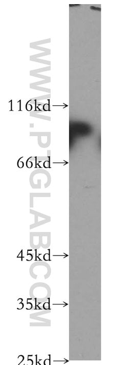 Plakophilin 3 Rabbit anti-Human, Mouse, Rat, Polyclonal, Proteintech:Antibodies:Primary