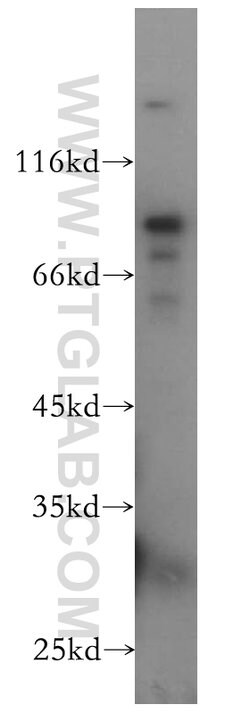Plakophilin 3 Rabbit anti-Human, Mouse, Rat, Polyclonal, Proteintech:Antibodies:Primary