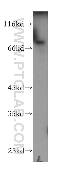 Plakophilin 3 Rabbit anti-Human, Mouse, Rat, Polyclonal, Proteintech:Antibodies:Primary
