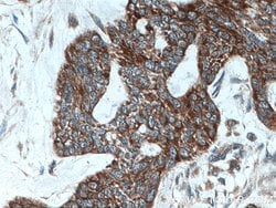 Cytokeratin 10 Rabbit anti-Human, Mouse, Rat, Polyclonal, Proteintech 20