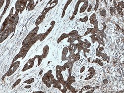 Cytokeratin 10 Rabbit anti-Human, Mouse, Rat, Polyclonal, Proteintech 20