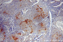 Cytokeratin 10 Rabbit anti-Human, Mouse, Rat, Polyclonal, Proteintech 20
