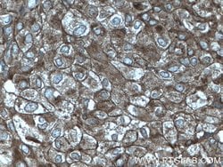 Cytokeratin 10 Rabbit anti-Human, Mouse, Rat, Polyclonal, Proteintech 20
