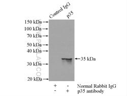 p35 Rabbit anti-Human, Mouse, Rat, Polyclonal, Proteintech 150 &mu;L; Unconjugated:Antibodies,