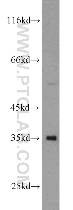 p35 Rabbit anti-Human, Mouse, Rat, Polyclonal, Proteintech 150 &mu;L; Unconjugated:Antibodies,