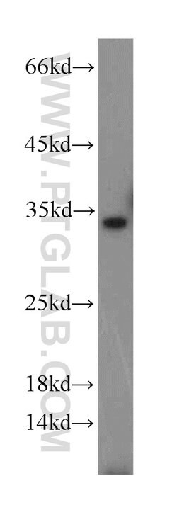 p35 Rabbit anti-Human, Mouse, Rat, Polyclonal, Proteintech 150 &mu;L; Unconjugated:Antibodies,