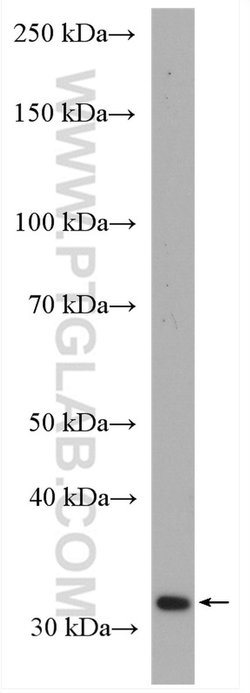 p35 Rabbit anti-Human, Mouse, Rat, Polyclonal, Proteintech 150 &mu;L; Unconjugated:Antibodies,
