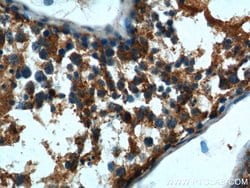 DTX1 Rabbit anti-Human, Mouse, Rat, Polyclonal, Proteintech 20 &mu;L; Unconjugated:Antibodies,