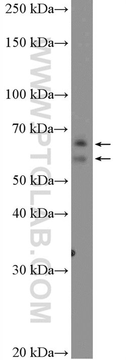 DTX1 Rabbit anti-Human, Mouse, Rat, Polyclonal, Proteintech 20 &mu;L; Unconjugated:Antibodies,
