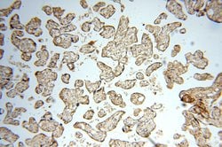 TEX14 Rabbit anti-Human, Mouse, Polyclonal, Proteintech 150 &mu;L | Buy Online | Proteintech Group Inc | Fisher Scientific