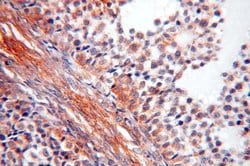 TEX14 Rabbit anti-Human, Mouse, Polyclonal, Proteintech 150 &mu;L | Buy Online | Proteintech Group Inc | Fisher Scientific